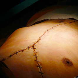 2015「鑑識英雄」男浮屍Y字型胸腔切口特效化妝 Prosthetics Make-up Effects of sutured Y-shaped incision (TV Series CSIC)